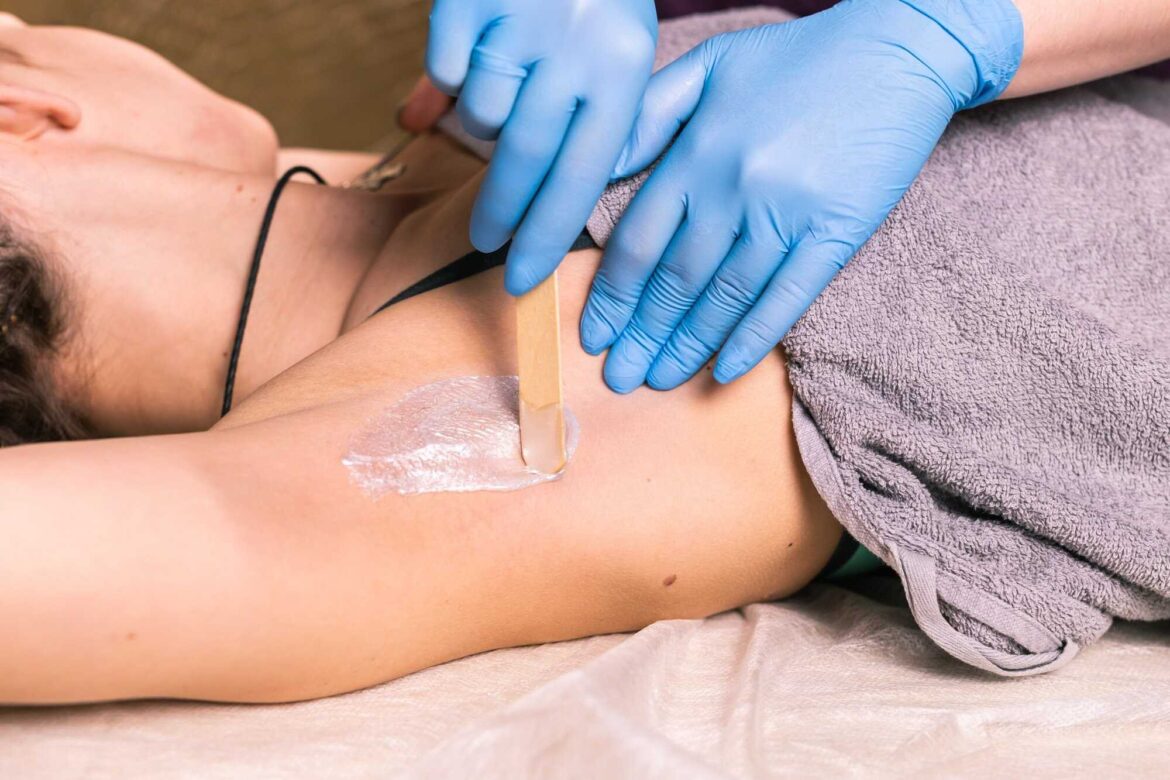 Underarm Ingrown Hair